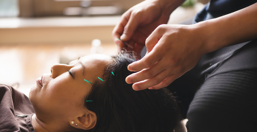 .Young woman receiving acupuncture treatment.